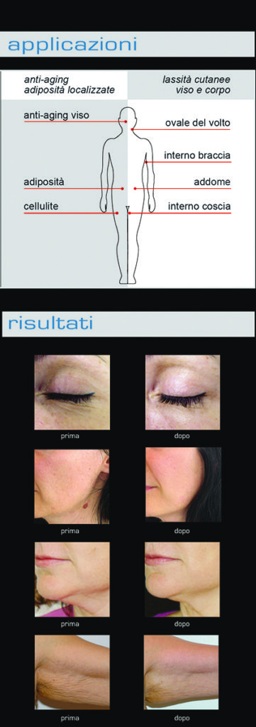1 multi injection laser com